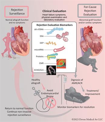 A gentler approach to monitor for heart transplant rejection